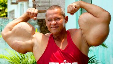 عوارض سیتول، سینتول چیست؟