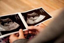 جنین دختر زودتر تکان می‌خورد یا جنین پسر