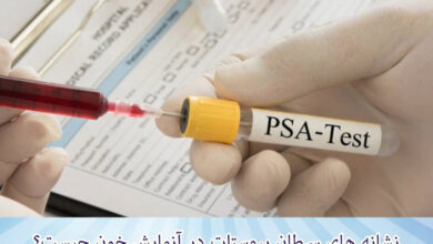 نشانه های سرطان پروستات در آزمایش خون چیست؟