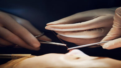 جراحی بینی به روش بسته و بدون تامپون چیست؟