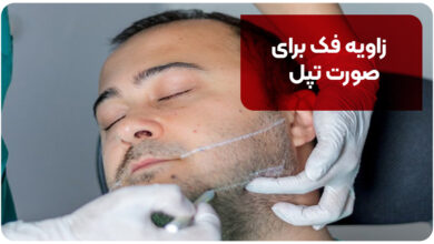 زاویه فک برای صورت تپل [روش‌ زاویه‌سازی فک برای صورت تپل]