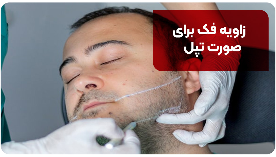 زاویه فک برای صورت تپل [روش‌ زاویه‌سازی فک برای صورت تپل]